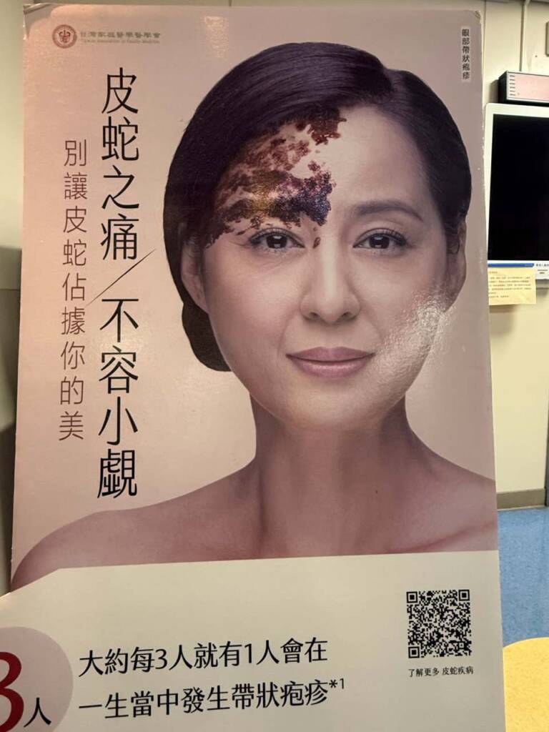 別輕忽帶狀疱疹疫苗(皮蛇)的可怕啊!